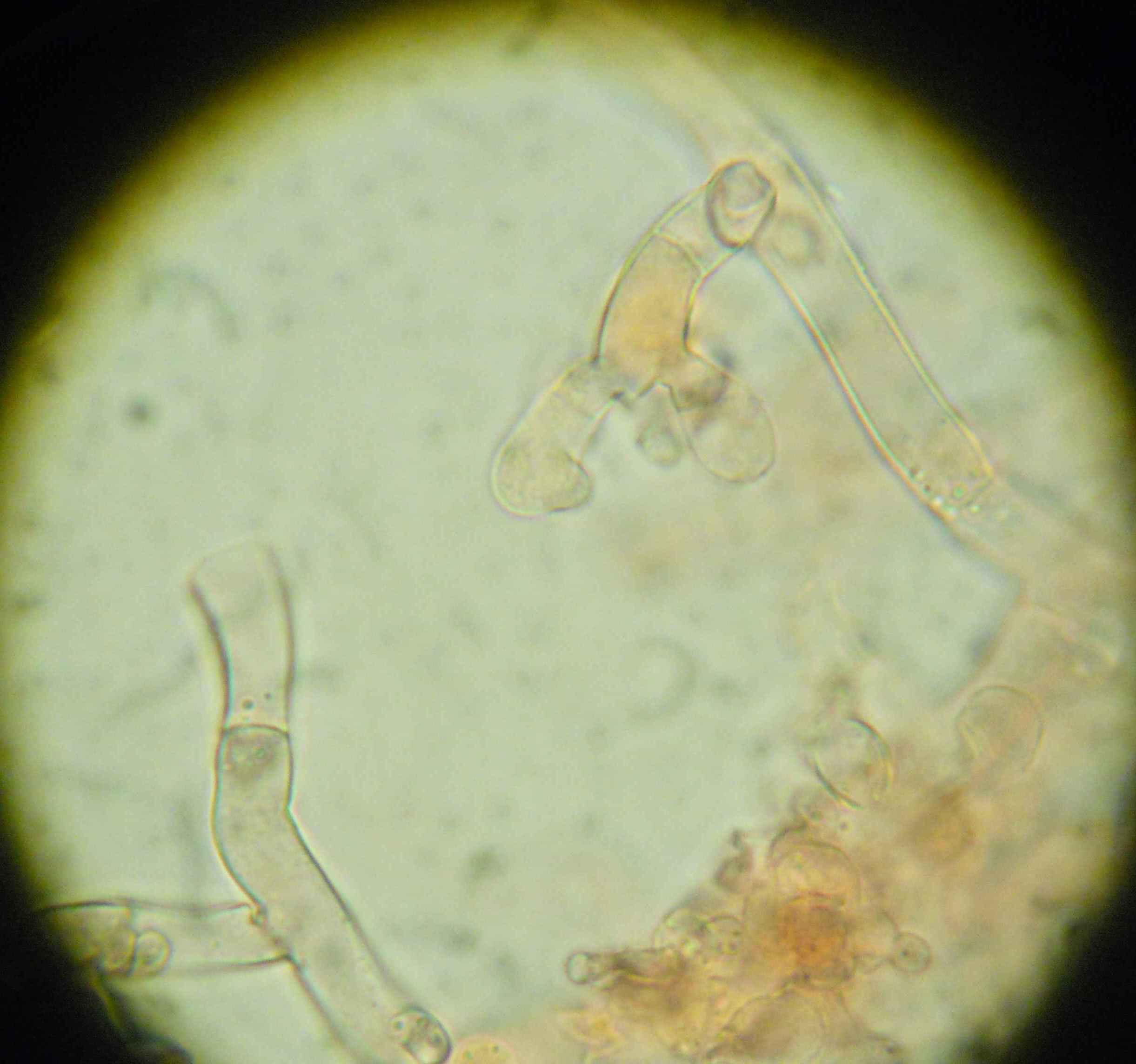 Botryobasidium? (Botryobasidium subcoronatum)